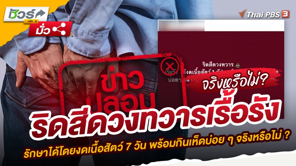 ข่าวปลอม : ริดสีดวงทวารเรื้อรัง รักษาได้โดยงดเนื้อสัตว์ 7 วัน พร้อมกินเห็ดบ่อย ๆ