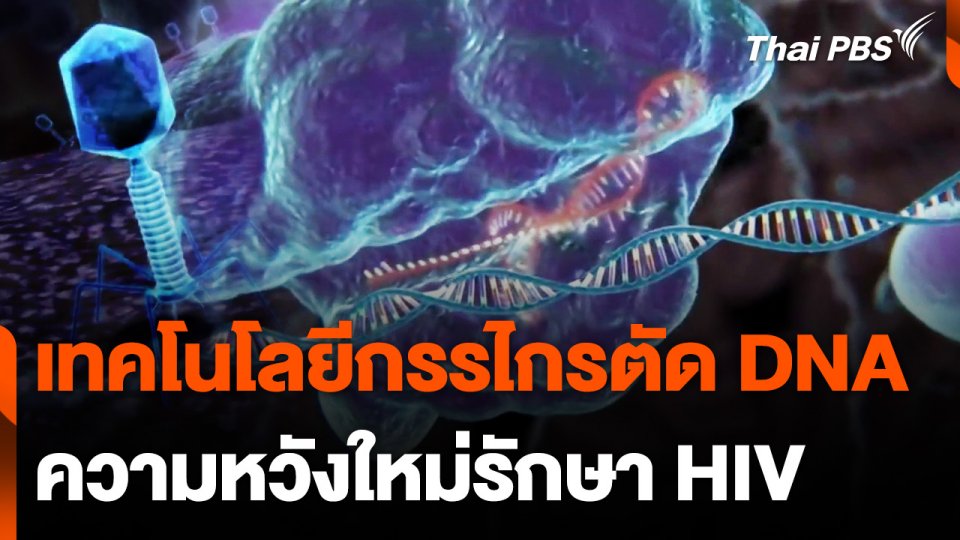 เทคโนโลยีกรรไกร ตัด DNA ความหวังใหม่รักษาผู้ติดเชื้อ HIV