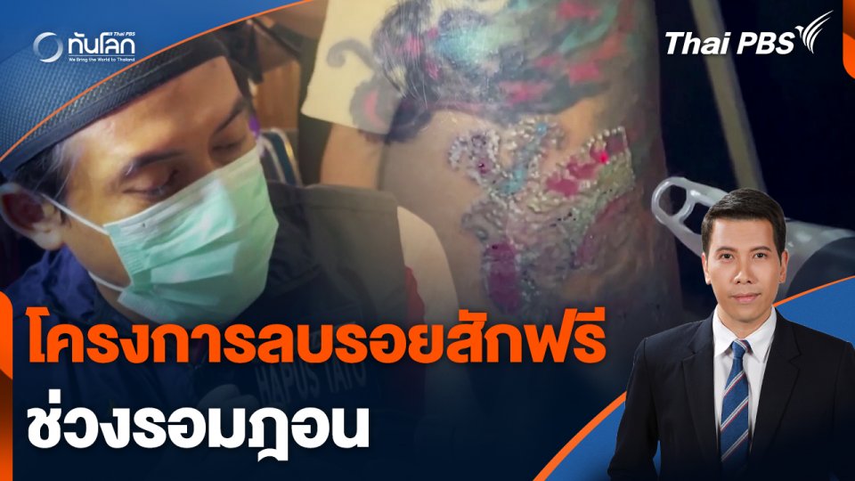 โครงการลบรอยสักฟรีช่วงรอมฎอน