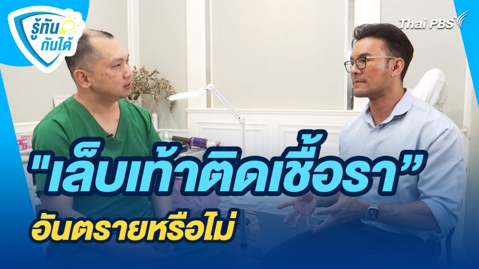 รู้ทันกันได้ : "เล็บเท้าติดเชื้อรา" อันตรายหรือไม่