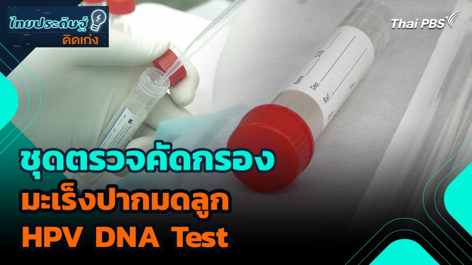 ไทยประดิษฐ์คิดเก่ง : ชุดตรวจคัดกรองมะเร็งปากมดลูก HPV DNA Test