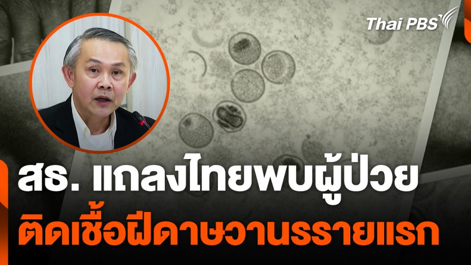 ไทยพบผู้ป่วยต่างชาติ วัย 66 ปี ติดเชื้อ "ฝีดาษวานร" รายแรก