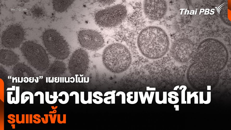 “หมอยง” เผยแนวโน้มฝีดาษวานรสายพันธุ์ใหม่ รุนแรงขึ้น