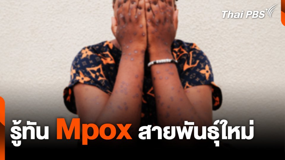 รู้ทัน Mpox สายพันธุ์ใหม่