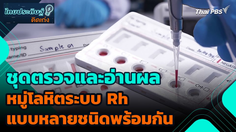 ไทยประดิษฐ์คิดเก่ง : ชุดตรวจและอ่านผลหมู่โลหิตระบบ Rh แบบหลายชนิดพร้อมกัน