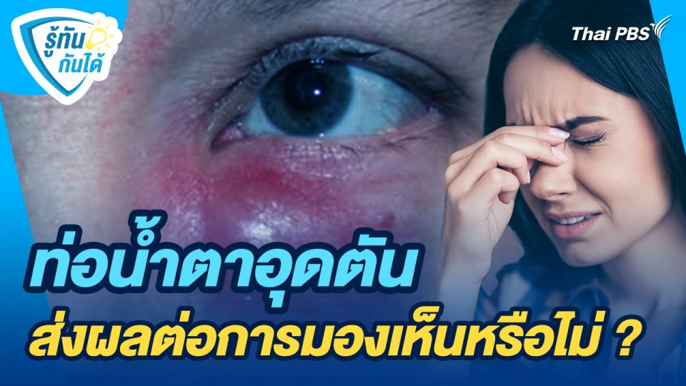 รู้ทันกันได้ : ท่อน้ำตาอุดตันส่งผลต่อการมองเห็นหรือไม่ ?