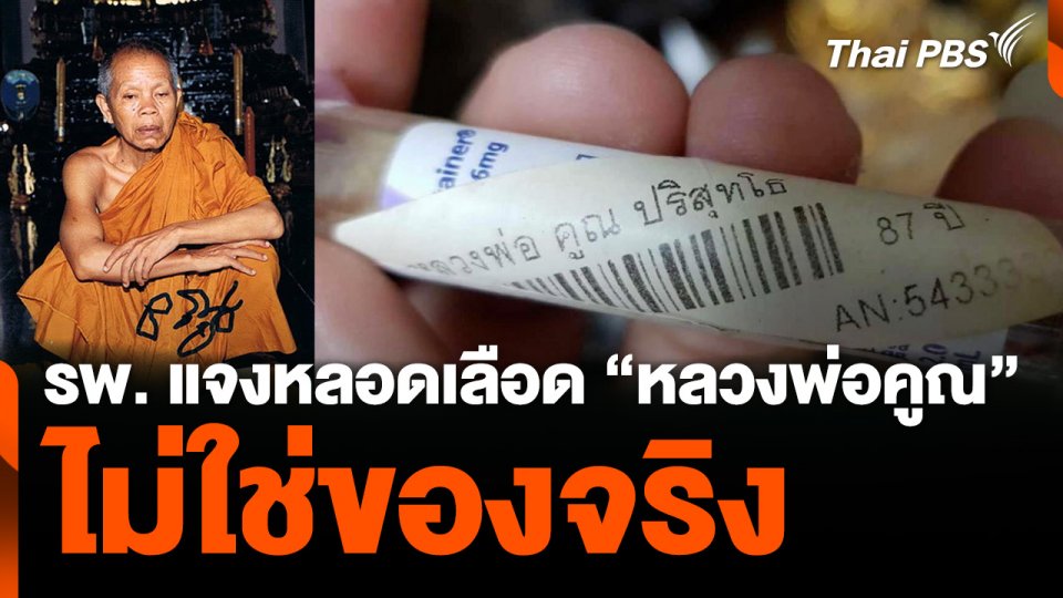รพ. แจงหลอดเลือด “หลวงพ่อคูณ” ไม่ใช่ของจริง