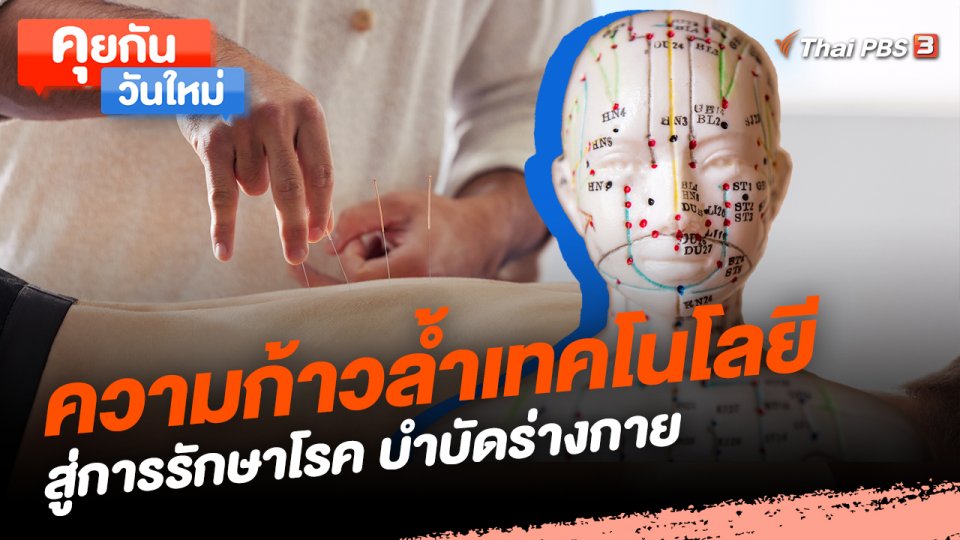คุยกันวันใหม่ : ความก้าวล้ำเทคโนโลยี สู่การรักษาโรค บำบัดร่างกาย