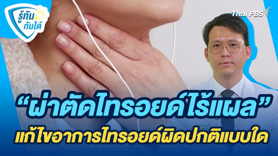 รู้ทันกันได้ : "ผ่าตัดไทรอยด์ไร้แผล" แก้ไขอาการไทรอยด์ผิดปกติแบบใด