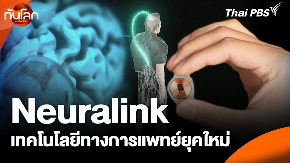 Neuralink เทคโนโลยีทางการแพทย์ยุคใหม่