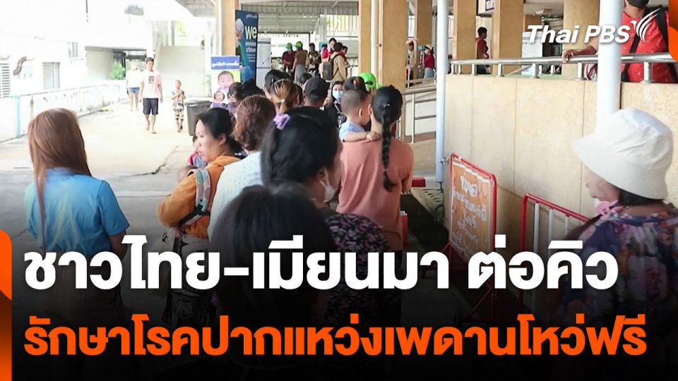 ชาวไทย-เมียนมา ต่อคิวรักษาโรคปากแหว่งเพดานโหว่ฟรี