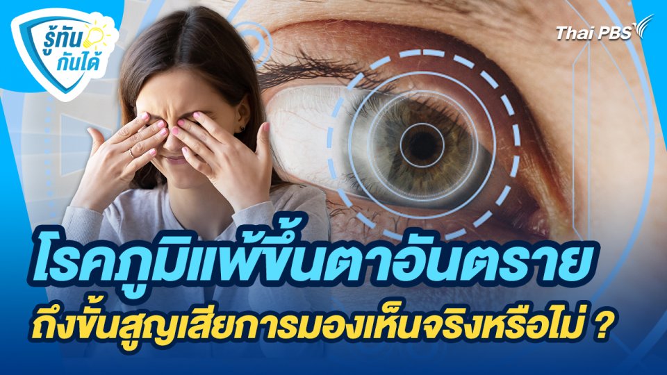รู้ทันกันได้ : โรคภูมิแพ้ขึ้นตาอันตรายถึงขั้นสูญเสียการมองเห็นจริงหรือไม่ ?
