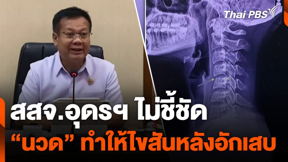 สสจ.อุดรฯ ไม่ชี้ชัด "นวด" ทำให้ไขสันหลังอักเสบ