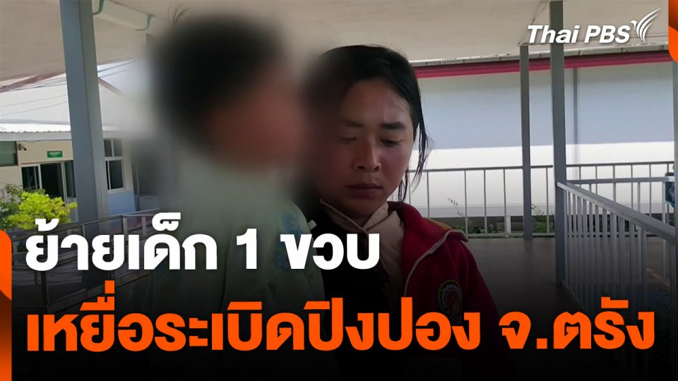 ย้ายด่วน เด็ก 1 ขวบ เหยื่อระเบิดปิงปอง จ.ตรัง