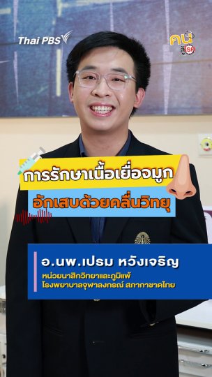 รู้จักการรักษาเนื้อเยื่อจมูกอักเสบด้วยคลื่นวิทยุ