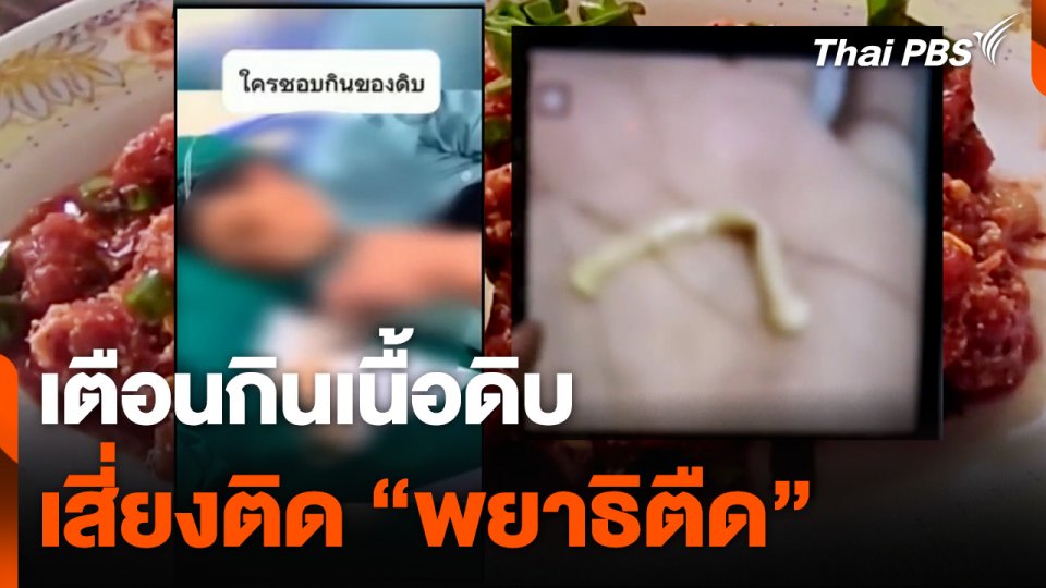 เตือนสายลาบ ก้อย ซอยจุ๊ ! กินเนื้อดิบ เสี่ยงติด "พยาธิตืด"