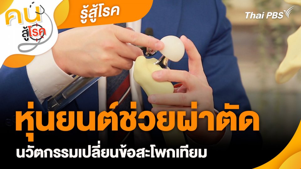 รู้สู้โรค : หุ่นยนต์ช่วยผ่าตัด นวัตกรรมเปลี่ยนข้อสะโพกเทียม