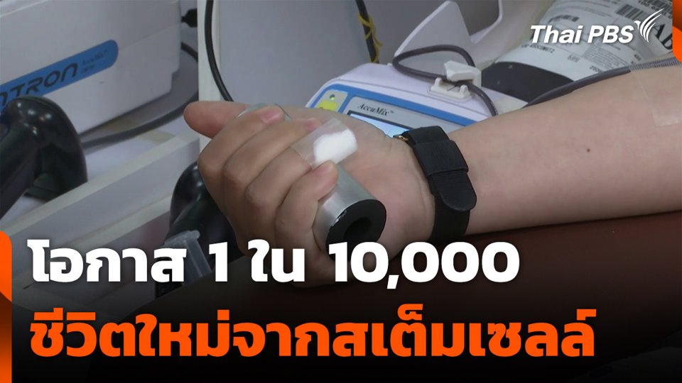 โอกาส 1 ใน 10,000 ชีวิตใหม่จากสเต็มเซลล์
