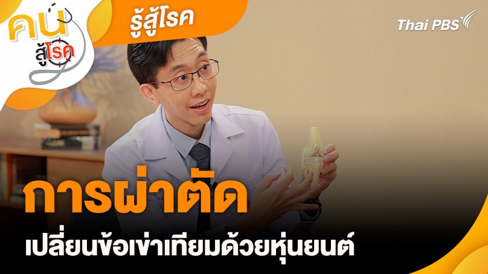 รู้สู้โรค : การผ่าตัดเปลี่ยนข้อเข่าเทียมด้วยหุ่นยนต์