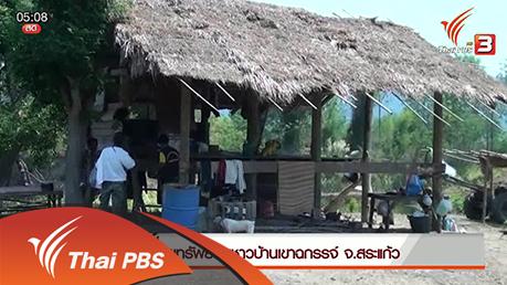 ประเด็นข่าว (29 ก.พ. 59)