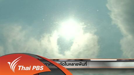 ประเด็นข่าว (21 มี.ค. 59)