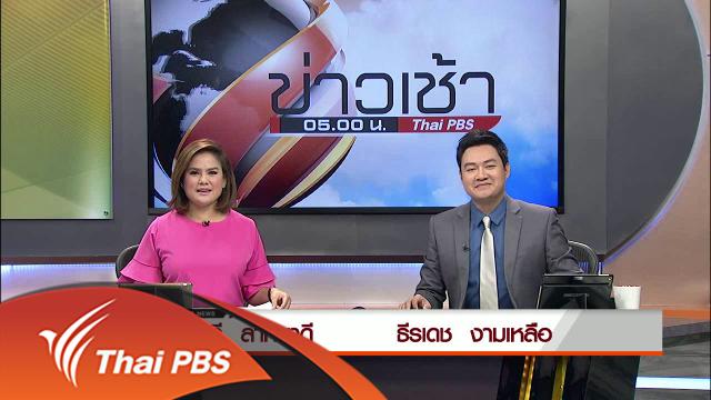 ประเด็นข่าว (3 พ.ค. 59)