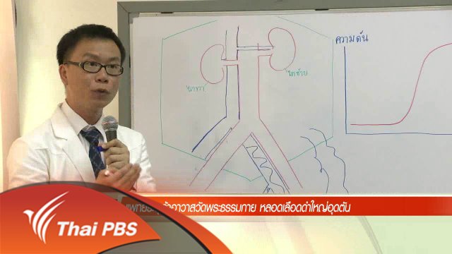 ประเด็นข่าว (14 พ.ค. 59)