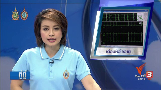 ที่นี่ Thai PBS : เตือนกลุ่มเสี่ยง "หัวใจวาย" ระวัง อาการลุ้น ตื่นเต้น