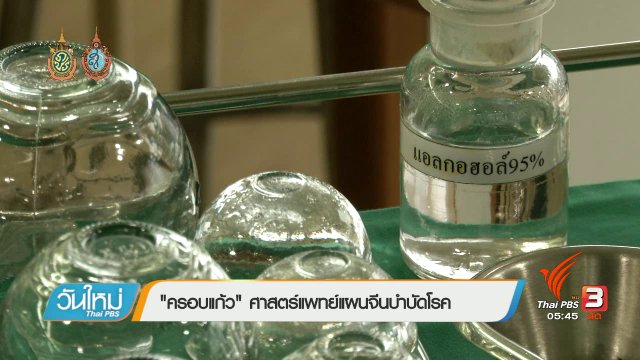 108 สุขภาพ : "ครอบแก้ว" ศาสตร์แพทย์แผนจีนบำบัดโรค