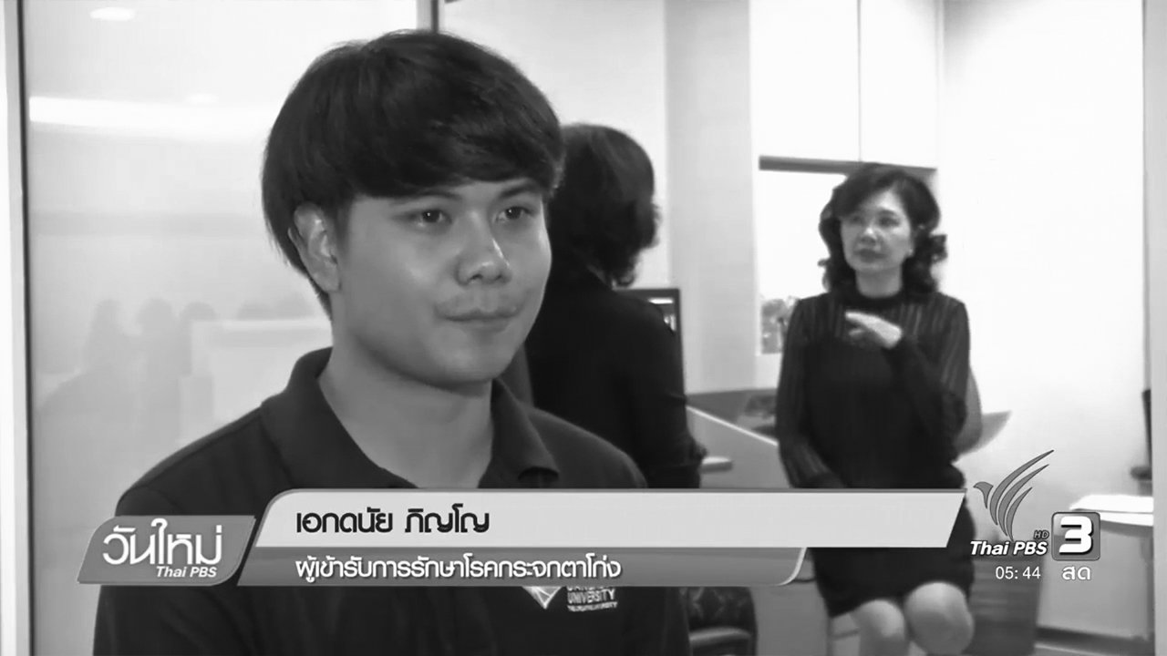 วันใหม่ ไทยพีบีเอส - สายตาสั้นเปลี่ยนแว่นบ่อย-ขยี้ตารุนแรง สัญญาณ "กระจกตาโก่ง"