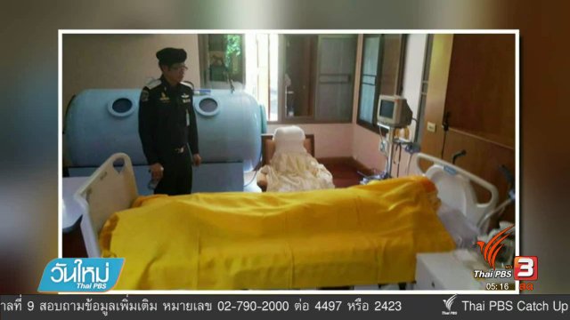 ประเด็นข่าว (17 ก.พ. 60)