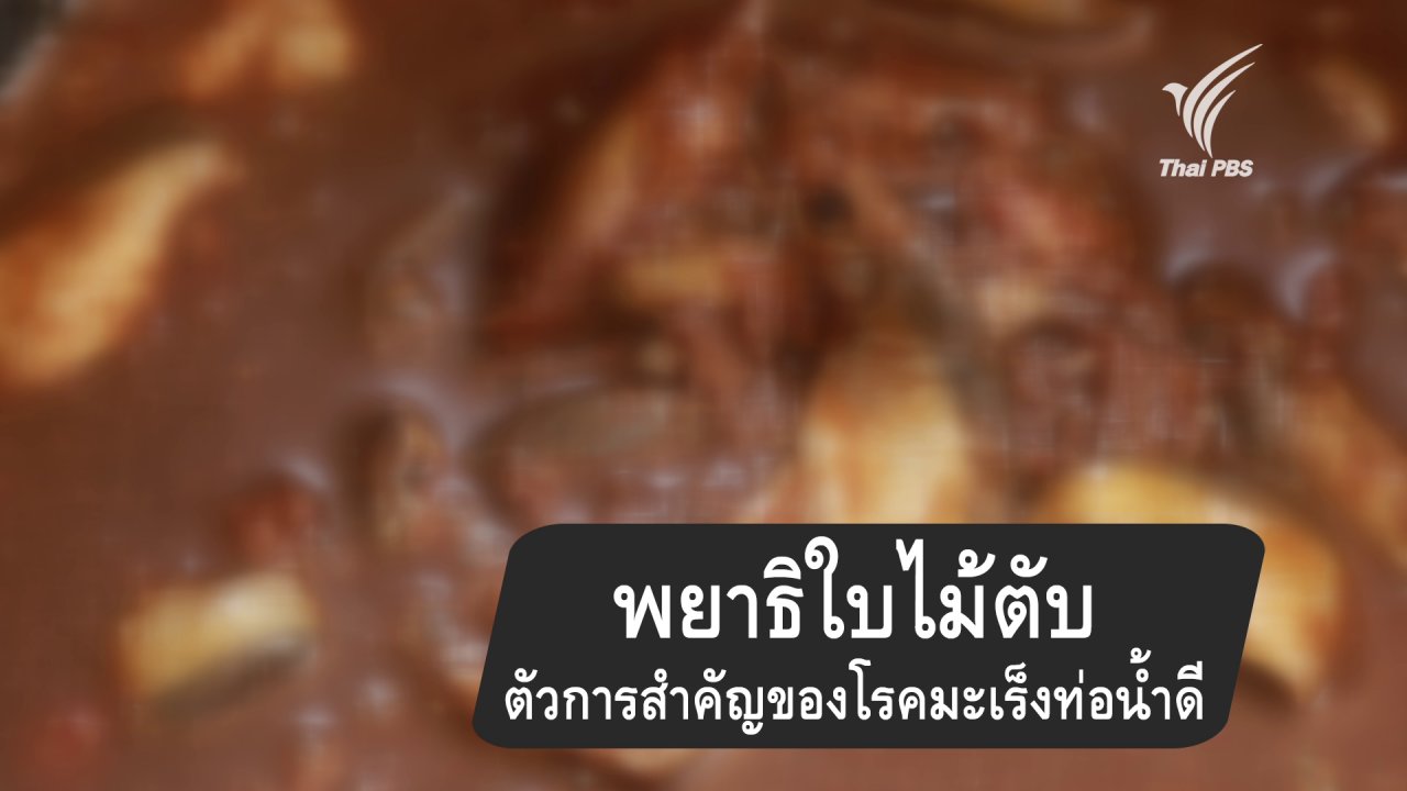 กินอยู่คือ - พยาธิใบไม้ในตับตัวการสำคัญของโรคมะเร็งท่อน้ำดี