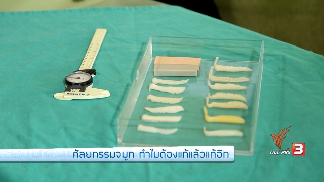 รู้สู้โรค : ศัลยกรรมจมูก ทำไมต้องแก้แล้วแก้อีก