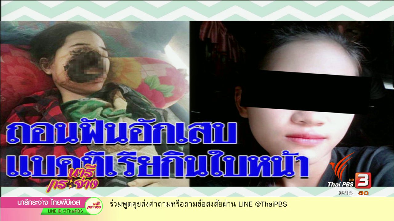 นารีกระจ่าง - จริงหรือ!! แบคทีเรียกินเนื้อคนเพราะไปทำฟัน ?