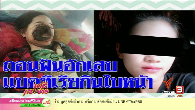 จริงหรือ!! แบคทีเรียกินเนื้อคนเพราะไปทำฟัน ?