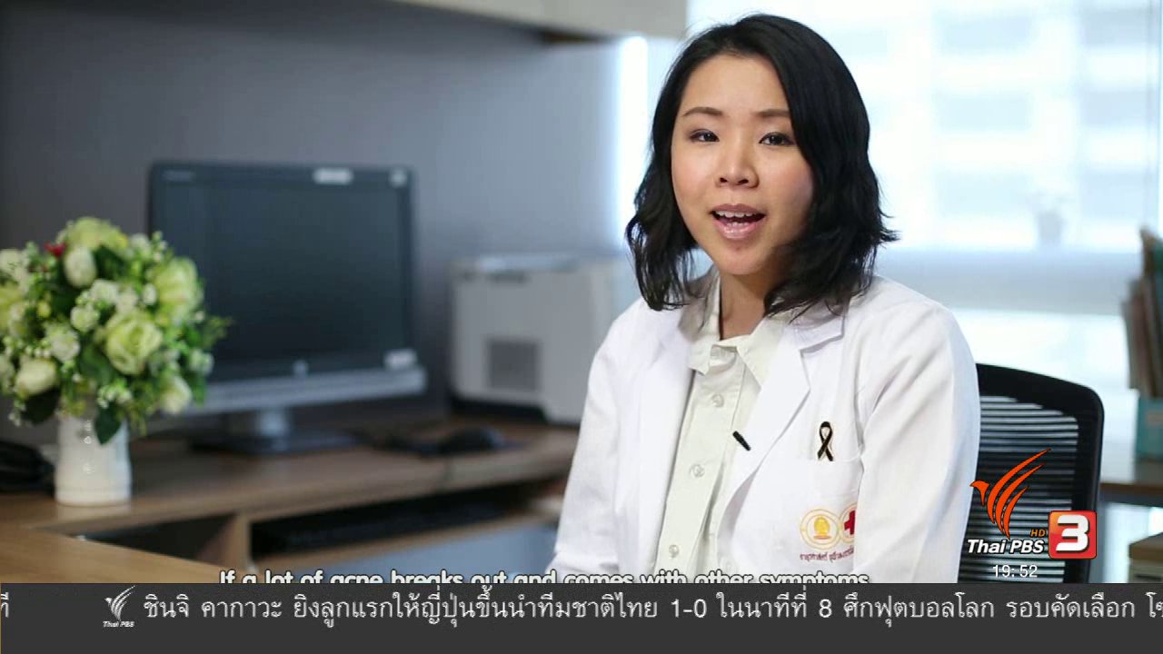ข่าวค่ำ มิติใหม่ทั่วไทย - soเชี่ยว FAKE or FACT : ตำแหน่งของสิวบอกโรคได้จริงหรือไม่