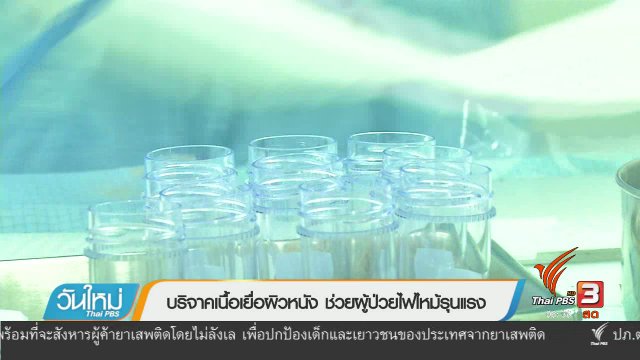 108 สุขภาพ : บริจาคเนื้อเยื่อผิวหนัง ช่วยผู้ป่วยไฟไหม้รุนแรง