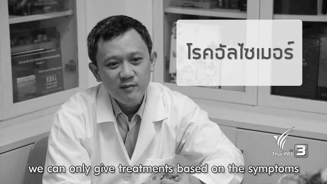 การแลบลิ้นเป็นประจำ สามารถลดการเกิดโรคอัลไซเมอร์ได้จริงหรือไม่