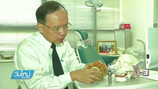 โครงการรากฟันเทียมเฉลิมพระเกียรติ