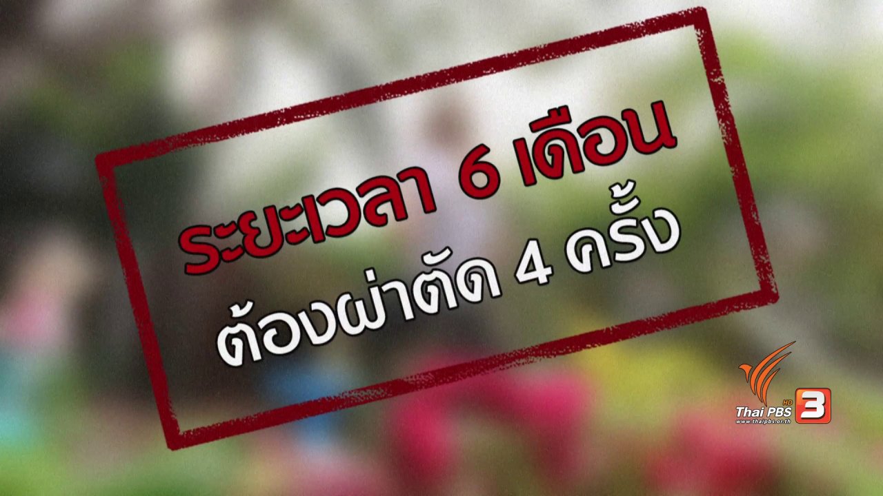 นารีกระจ่าง - ภัยรอบตัว : เสี่ยงหน้าอกเน่าเพราะศัลยกรรม