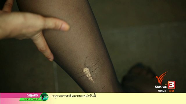 สุดยอดแม่บ้าน : วิธียืดอายุการใช้งานถุงน่อง