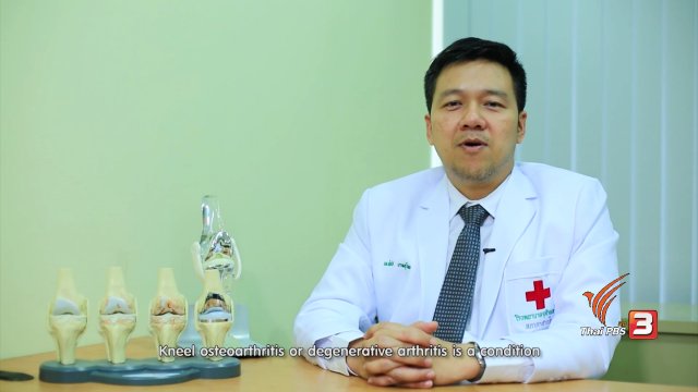 soเชี่ยว FAKE or FACT : การวิ่งจ็อกกิงสามารถทำให้ข้อเข่าเสื่อมได้หรือไม่