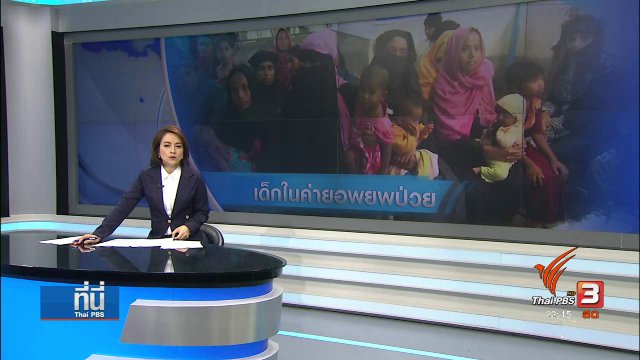 เด็กในค่ายอพยพโรฮิงญาป่วย