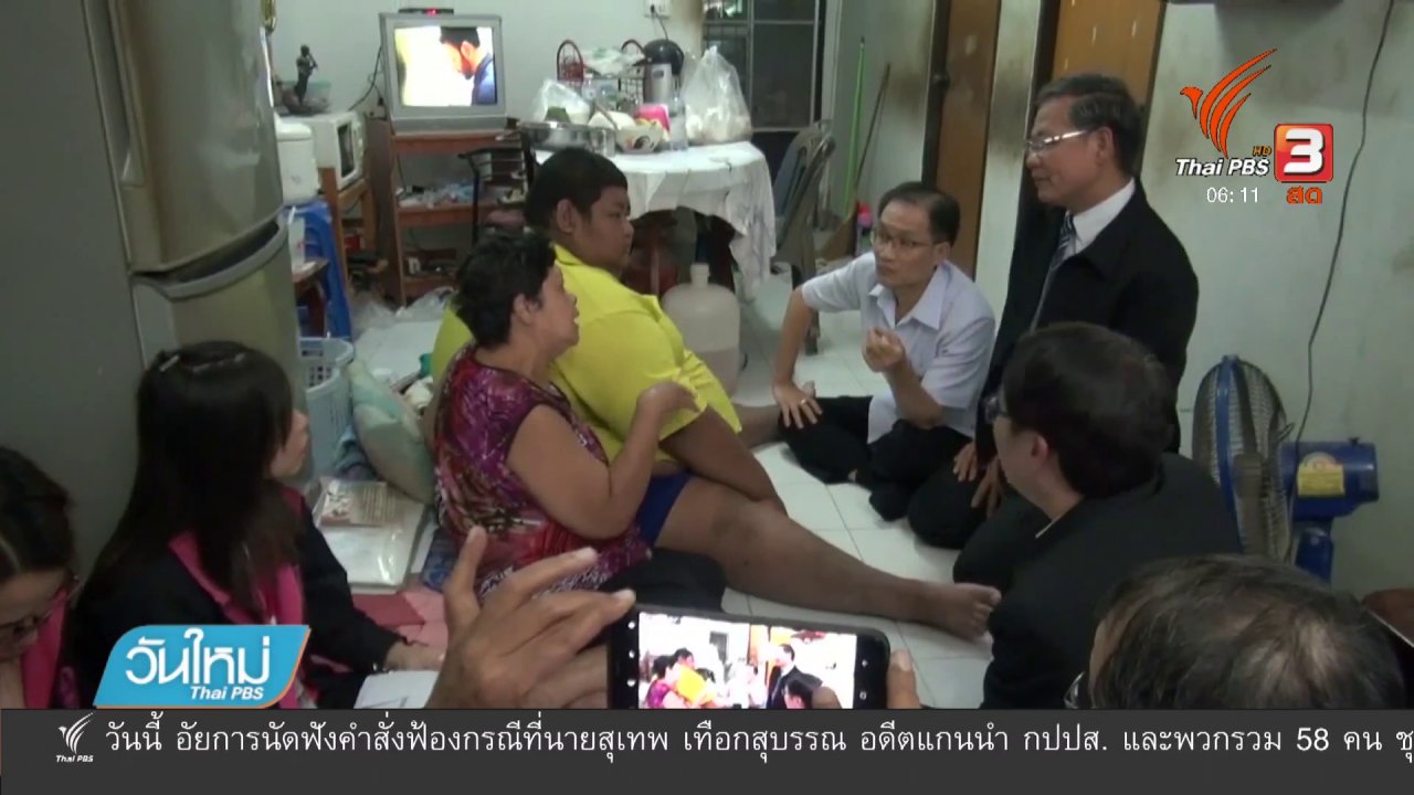 วันใหม่ ไทยพีบีเอส - เตรียมผ่าตัดกระเพาะช่วยผู้ป่วยโรคอ้วน