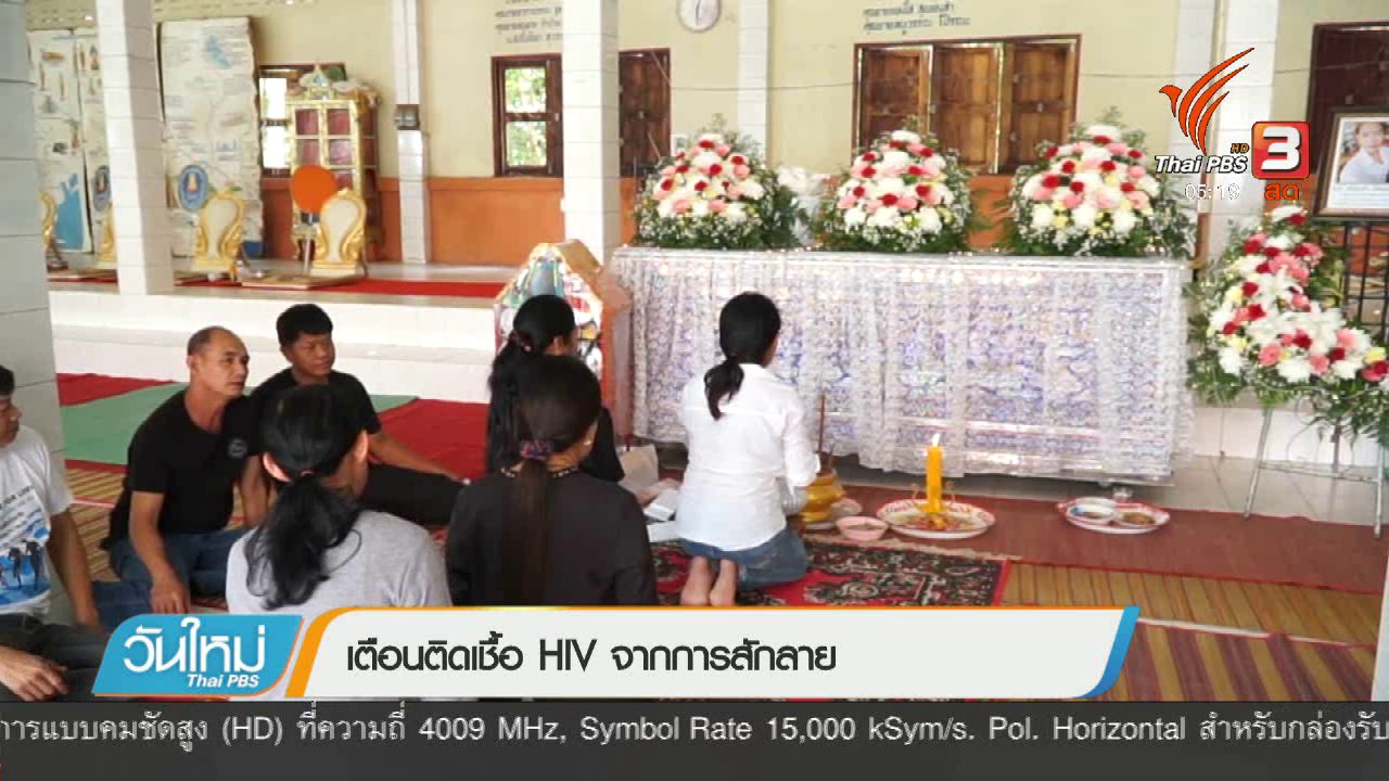 วันใหม่ ไทยพีบีเอส - เตือนติดเชื้อ HIV จากการสักลาย