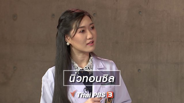 นิ่วทอนซิล