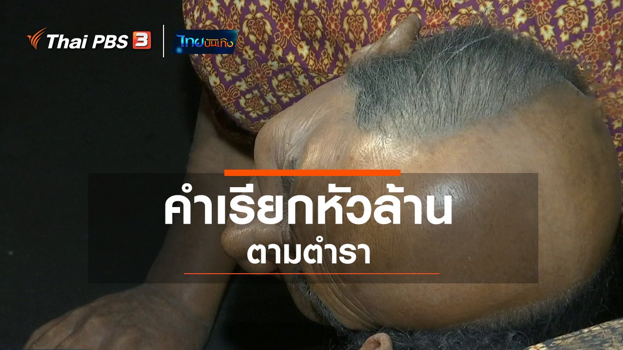 ไทยบันเทิง - เพียงคำเดียว : คำเรียกหัวล้านตามตำรา