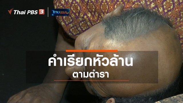 เพียงคำเดียว : คำเรียกหัวล้านตามตำรา