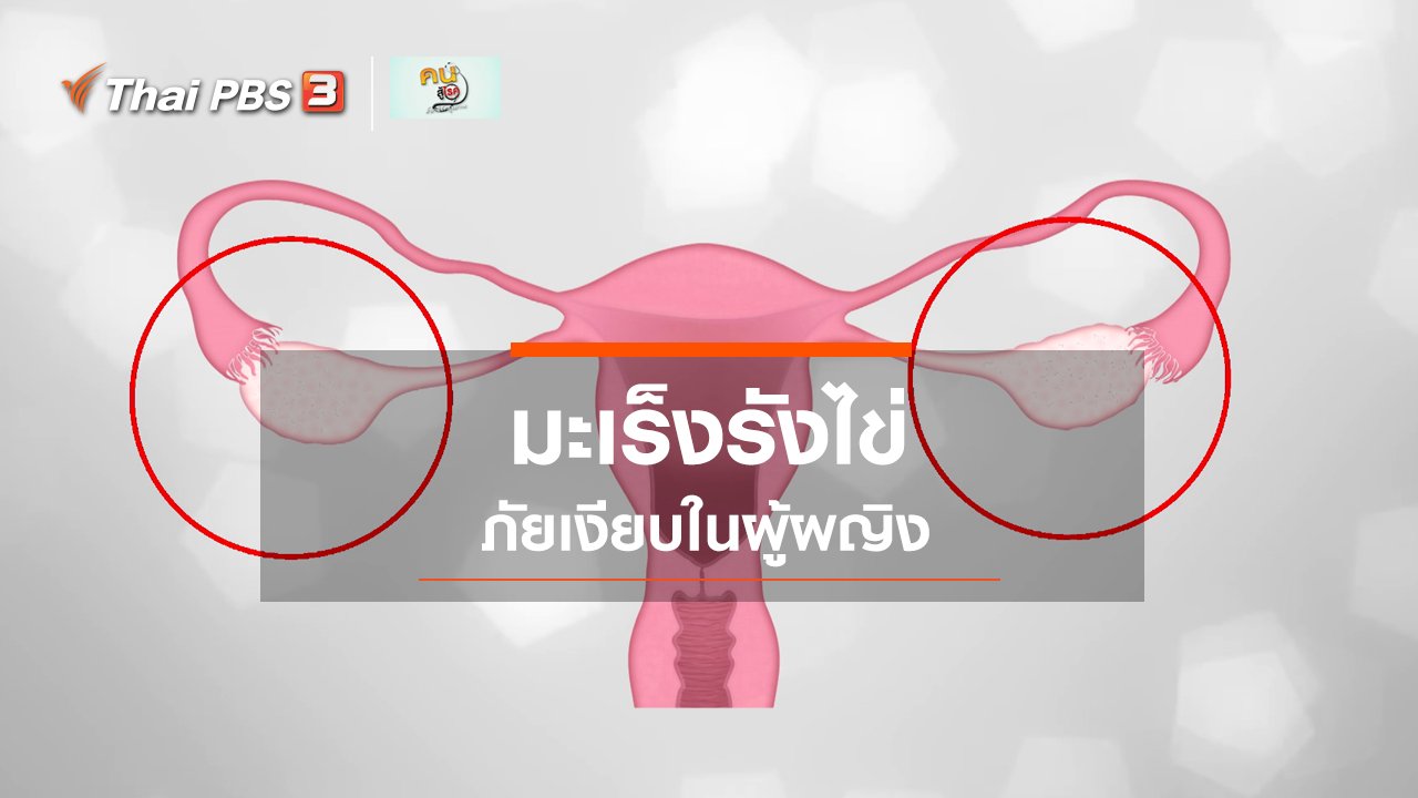 คนสู้โรค - รู้สู้โรค : มะเร็งรังไข่ ภัยเงียบในผู้ผญิง