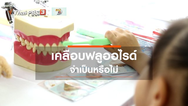 รู้สู้โรค : การเคลือบฟลูออไรด์จำเป็นหรือไม่